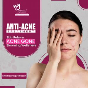 anti acne