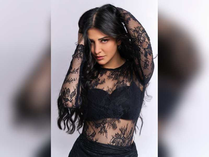 Shruti Haasan Shares Her Dental Dilemma and Exciting Vacation Plans on Instagram Stories